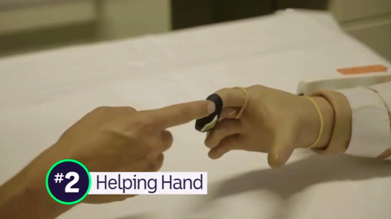 Prosthetic Hand - Now to Italy, where a proto... - ClickView
