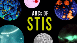 ABCs of STIS