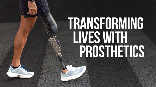 Engineering: Transforming Lives with Prosthetics